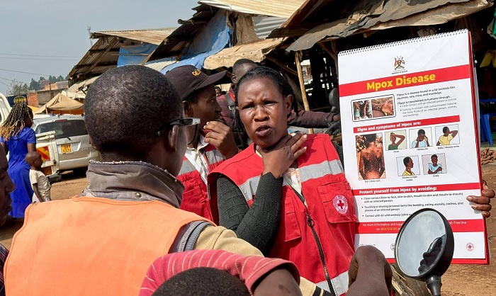 Global Waspada! Wabah Ebola Melanda Uganda, Bocah Berusia 4 Tahun Meninggal