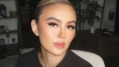 Mengenal Alopecia Areata, Penyakit yang digunakan dimaksud Menjangkit Agnez Mo hingga Alami Kebotakan